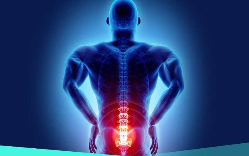 douleur due à l'arthrite de la hanche